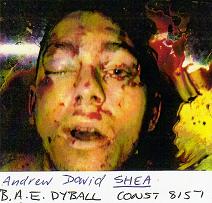 police identification photograph, mouth open, no broken jawbone