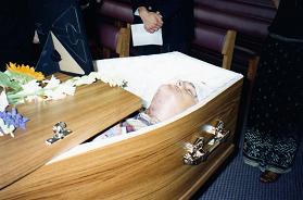 Andrew in coffin, broken jawbone, tracheotomy wounds